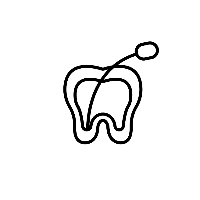 root canal